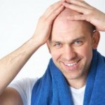 Can Saw Palmetto Stop Baldness ?